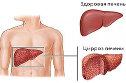 Реферат: Алкоголь и его отрицательное действие на организм